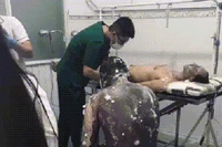 Bình Dương: Nổ lớn ở công ty gỗ, nhiều công nhân bỏng nặng