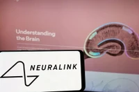 Neuralink thành công bước đầu trong thử nghiệm cấy chip vào não người