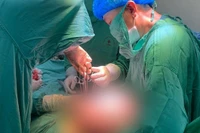 Bụng to bất thường, người phụ nữ mang khối u buồng trứng khổng lồ