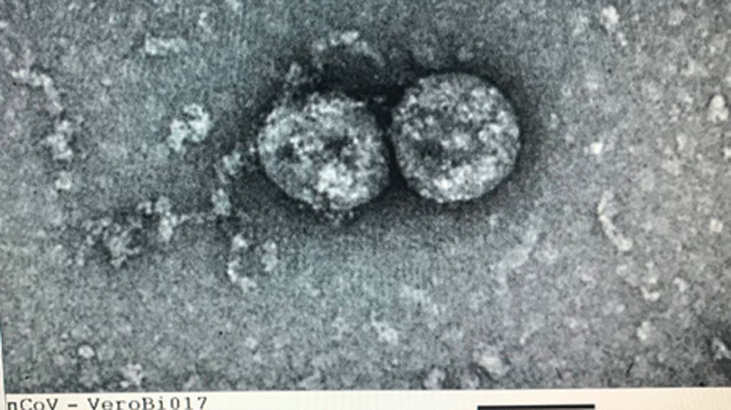 Virus SARS-CoV-2 do các nhà khoa học thuộc Viện Vệ sinh dịch tễ T.Ư nuôi cấy, phân lập từ bệnh phẩm của bệnh nhân ghi nhận đầu vụ dịch Covid-19. ẢNH LIÊN CHÂU