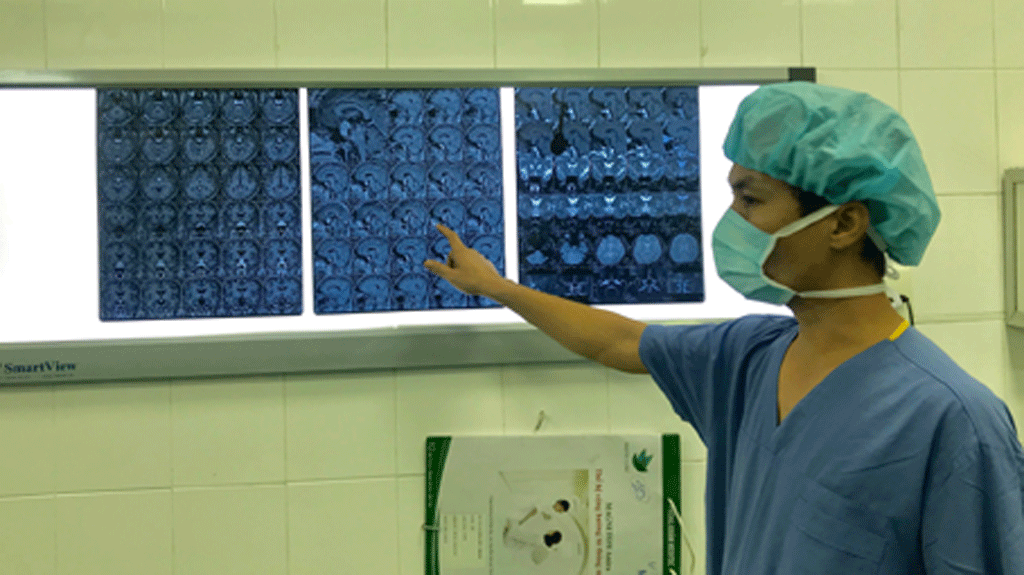Bác sĩ phẫu thuật đánh giá vị trí khối u não trước phẫu thuật cho bệnh nhân - ẢNH LIÊN CHÂU