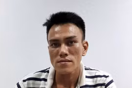 "Hot boy" tẩm xăng đốt người yêu trong cơn cuồng ghen