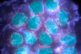 Xác định được các gene đột biến có khả năng gây bệnh ung thư vú