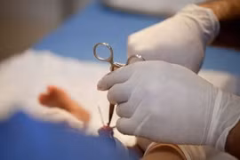 Bác sĩ ơi: Mới cắt bao quy đầu, có phải bị viêm nhiễm?