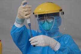 Trường hợp dương tính SARS-CoV-2 ở Cầu Giấy: Xác định được 5 F1, 8 F2