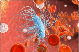 Nhiễm trùng huyết là gì mà nhiều bệnh nhân Covid-19 tử vong đều bị?