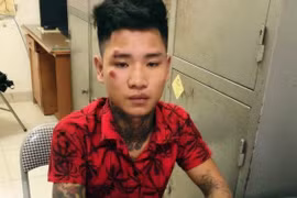 Tạm giữ hình sự đối tượng ngổ ngáo, đâm dập đùi trung úy cảnh sát