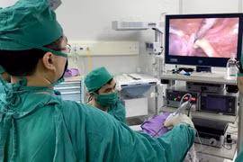 Khóc cười khi vòng tránh thai chui vào ổ bụng