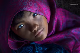 Cô gái Việt kỳ lạ với đôi mắt hai màu vào đại học