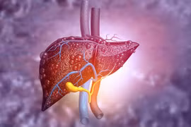 5 loại trái cây tốt nhất để trị gan nhiễm mỡ bạn cần biết