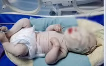 Thêm 1 bé sơ sinh mắc bệnh hiếm, toàn thân bọc vảy trắng nhiều vết nứt