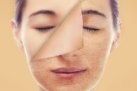 Cách chăm sóc da tại nhà giúp làn da không bị khô nẻ trong mùa đông