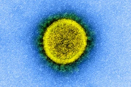 Thêm bằng chứng cho thấy nữ tử vong vì Covid-19 ít hơn nam