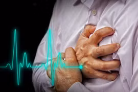 Phân tích hình ảnh chụp CT giúp cảnh báo sớm bệnh đau tim