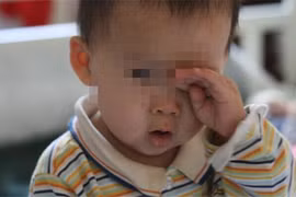 Bé trai 2 tuổi suýt bị mù vĩnh viễn chỉ vì bố mẹ 'lười'