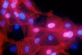 Thuốc mới chống ung thư vú