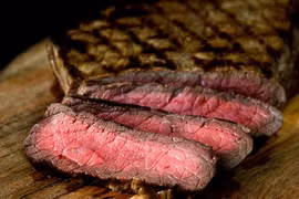 6 điều ít ai ngờ tới lại có thể gây bệnh sỏi thận