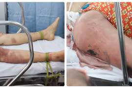 Làm lễ trừ tà, "pháp sư" đánh hai phụ nữ nhập viện