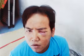 Hé lộ nguyên nhân bảo vệ dân phố sát hại bé trai 6 tuổi