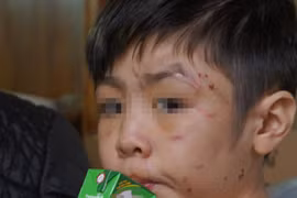 Phút trốn chạy khỏi nhà của bé 10 tuổi 'tố' bị bố bạo hành