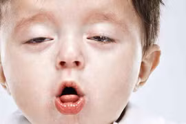 Mẹo chữa ho cho trẻ không cần dùng thuốc