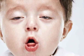 Mẹo chữa ho cho trẻ không cần dùng thuốc