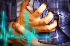 Tại sao có những người trông rất khỏe mạnh vẫn bị đột quỵ?