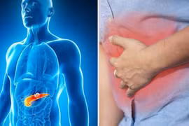 70% người ung thư tuyến tụy gặp triệu chứng này sau khi ăn