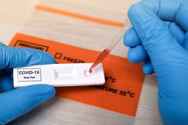 Doanh nghiệp chi hàng nghìn tỉ đồng nhập khẩu kit test COVID-19 lên tiếng