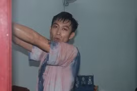 Kẻ "ngáo đá" đâm loạn xạ làm 3 người trọng thương