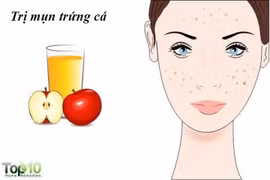 Giấm táo mang lại nhiều lợi ích không ngờ cho phụ nữ