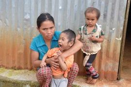 Nhà nghèo, con lại bị bại não