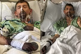 Vi khuẩn ăn thịt người tấn công người đàn ông sau 1 mũi tiêm