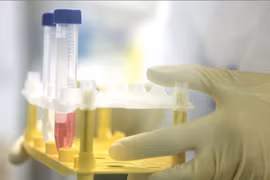 WHO cảnh báo việc chủ động lây nhiễm virus corona để tăng tốc nghiên cứu vắcxin