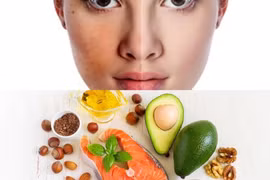 4 "siêu" thực phẩm có khả năng chống lão hóa da