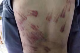 Thanh Hóa:Cháu bé bị sư thầy bạo hành nói gì tại cơ quan công an?