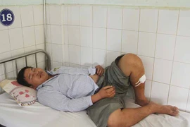 Gia Lai: Đình chỉ điều tra vụ án chém 4 chiến sĩ công an