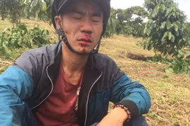 Xô xát vì tranh chấp khu đất trồng cà phê, một nông dân bị đánh