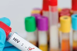 Nam Phi ra mắt thuốc điều trị HIV/AIDS hiệu quả cao