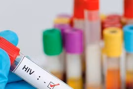Nam Phi ra mắt thuốc điều trị HIV/AIDS hiệu quả cao