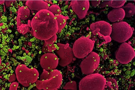 Kháng thể có thể chống lại các biến thể của SARS-CoV-2 trong 6 tháng