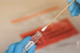 Tìm ra phương pháp xét nghiệm Covid-19 trong 1 giây