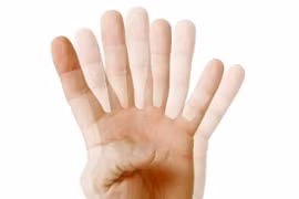 4 dấu hiệu hiếm gặp của huyết áp cao nguy hiểm