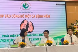 Hà Nội: Ca song thai cùng trứng cực kỳ đặc biệt, thế giới mới ghi nhận 1 trường hợp