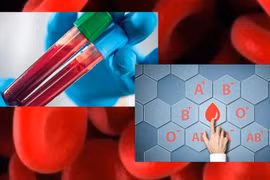 Phát hiện người mang nhóm máu này có nguy cơ bị tăng huyết áp nguy hiểm