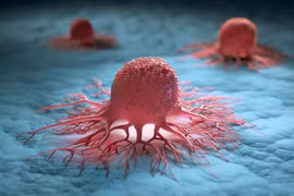 Đột phá: Phát hiện thứ có thể khiến ung thư ngừng di căn