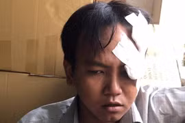 Bảo vệ dân phố sát hại bé 6 tuổi là người tâm thần phân liệt