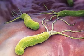 Quá nhiều vi khuẩn HP sinh sống trong dạ dày, cơ thể sẽ cầu cứu bằng 3 tín hiệu này