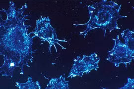 Phát hiện yếu tố ngay trong cơ thể khiến tế bào ung thư "tự sát"