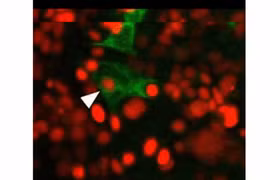 Tìm ra cơ chế khiến bệnh ung thư 'né' được hóa trị